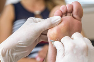 Chiropodia podoactiva